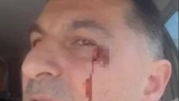 ДРАМА У ЦРВЕНКИ: Блокадери претукли човека насред улице- разбијена му аркада! (ВИДЕО) ДРАМА У ЦРВЕНКИ: Блокадери претукли човека насред улице- разбијена му аркада! (ВИДЕО)