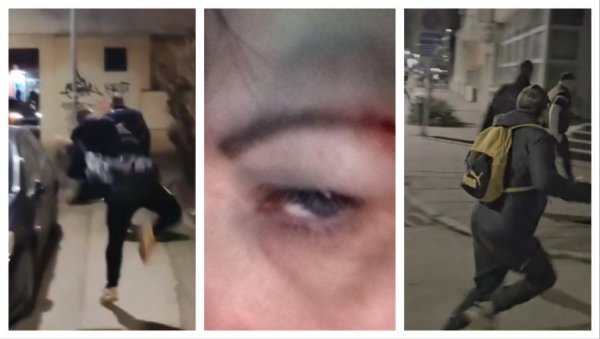 ЈЕЗИВО НАСИЉЕ БЛОКАДЕРА ФОТЕЉАША У НИШУ КОЈЕ НЕ СМЕ ДА СЕ ЗАБОРАВИ: Да ли неко заиста жели овакву Србију? (ВИДЕО) ЈЕЗИВО НАСИЉЕ БЛОКАДЕРА ФОТЕЉАША У НИШУ КОЈЕ НЕ СМЕ ДА СЕ ЗАБОРАВИ: Да ли неко заиста жели овакву Србију? (ВИДЕО)