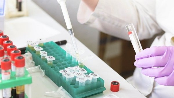 ОГЛАСИО СЕ БАТУТ: У Србији регистрована два случаја грознице Западног Нила ОГЛАСИО СЕ БАТУТ: У Србији регистрована два случаја грознице Западног Нила